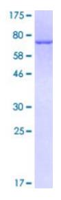 SDS-PAGE (KRT17-017H).jpg